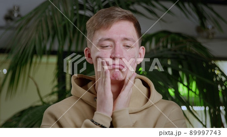 Close-up of a young man with pimples on his face. The guy is sad and pulls the skin of his face in different directions. 89997743