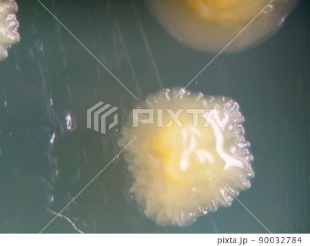 コロニーの輪郭がギサギサしているコロニー 90032784