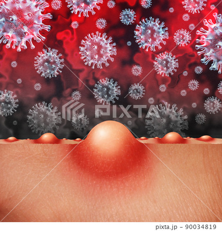 Monkeypox Virus 90034819
