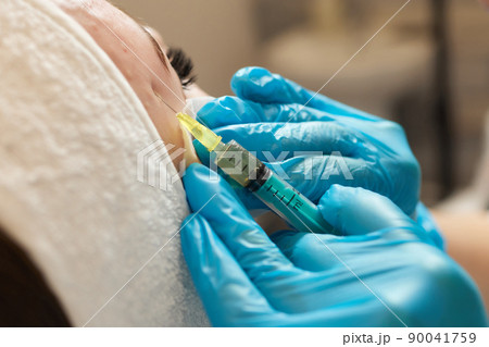 Syringe with a patient's blood plasma in a cosmetologist's hand for a plasmolifting of a woman's facial skin. Plasma therapy, skin cell restoration. 90041759