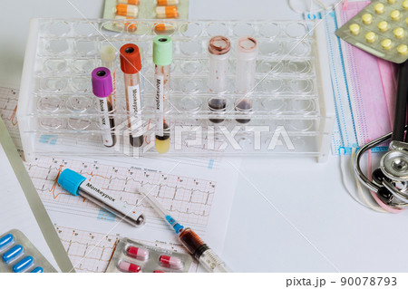 Monkeypox virus infection blood sample test with pills, tablets blood test in laboratory Monkeypox virus infection blood sample test with pills, tablets blood test in laboratory 90078793