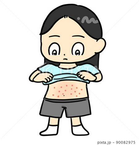 お腹に発疹のある子ども お腹に発疹のある子ども 90082975