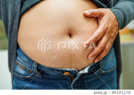 Asian woman show fat belly big size overweight and obesity at office. Asian woman show fat belly big size overweight and obesity at office. 90101176