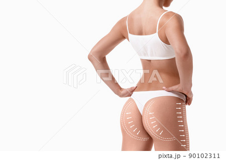 Female body with the drawing arrows on it isolated on white. Fat lose, liposuction and cellulite removal concept. Female body with the drawing arrows on it isolated on white. Fat lose, liposuction and cellulite removal concept. 90102311