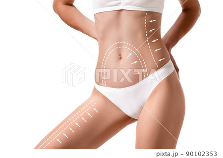 Female body with the drawing arrows on it isolated on white. Fat lose, liposuction and cellulite removal concept. 90102353