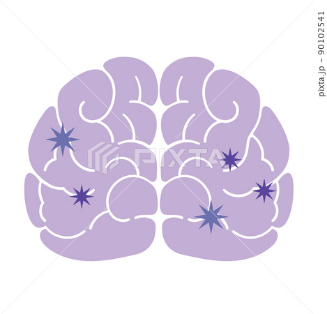 正面から見た細菌感染した脳 90102541