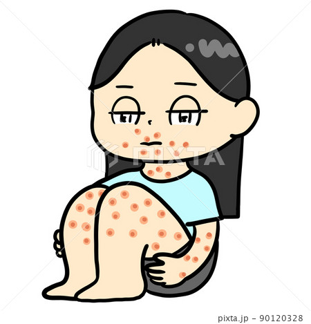 全身に湿疹ができた子どものイラスト素材