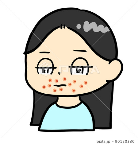 口周りに湿疹ができた子ども 口周りに湿疹ができた子ども 90120330