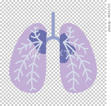 Lungs with cancer cells 90141723