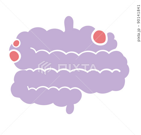 ポリープのできた腸 ポリープのできた腸 90141841