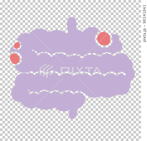 ポリープのできた腸 ポリープのできた腸 90141841