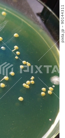 様々な形のコロニーの観察 様々な形のコロニーの観察 90144311