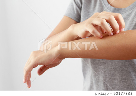 Health problems, woman has itchy hands Health problems, woman has itchy hands 90177333