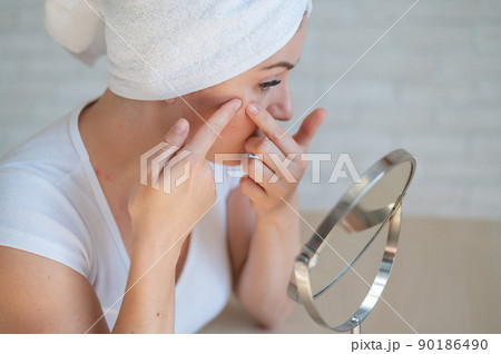 A Caucasian woman with a white terry towel on her head looks in the mirror and crushes pimple. Problem skin during menstruation. Acne and hyperandrogenism due to hormonal disorders. 90186490