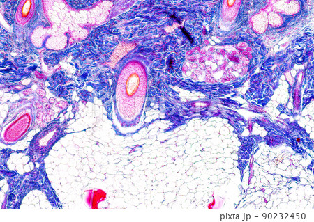 Scalp and hair follicles of human under the microscope in Lab. 90232450