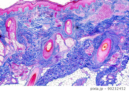 Scalp and hair follicles of human under the microscope in Lab. 90232452