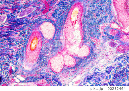 Scalp and hair follicles of human under the microscope in Lab. 90232464