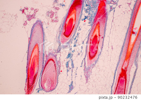 Scalp and hair follicles of human under the microscope in Lab. Scalp and hair follicles of human under the microscope in Lab. 90232476