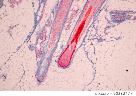 Scalp and hair follicles of human under the microscope in Lab. 90232477