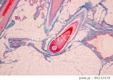 Scalp and hair follicles of human under the microscope in Lab. Scalp and hair follicles of human under the microscope in Lab. 90232478