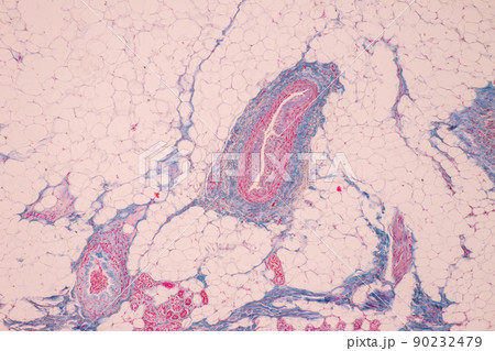 Scalp and hair follicles of human under the microscope in Lab. Scalp and hair follicles of human under the microscope in Lab. 90232479