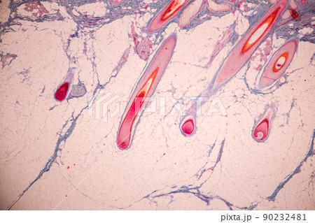Scalp and hair follicles of human under the microscope in Lab. Scalp and hair follicles of human under the microscope in Lab. 90232481