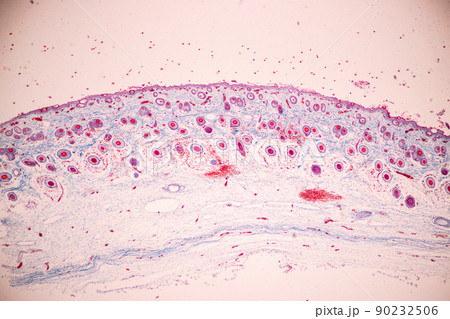 Scalp and hair follicles of human under the microscope in Lab. Scalp and hair follicles of human under the microscope in Lab. 90232506