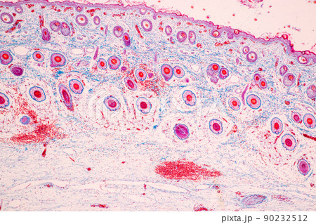 Scalp and hair follicles of human under the microscope in Lab. 90232512