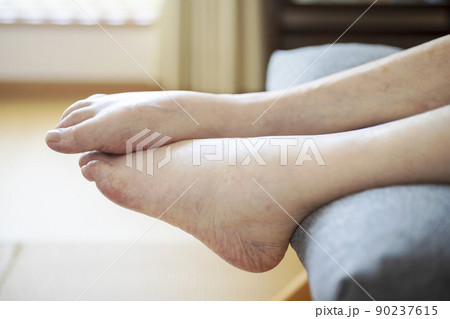 高齢者の足のむくみ 90237615