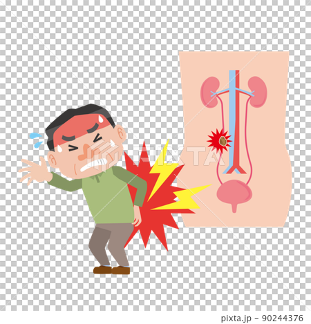 患有輸尿管結石疼痛的男人 患有輸尿管結石疼痛的男人 90244376