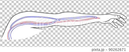 透析分流器的插圖 90262671