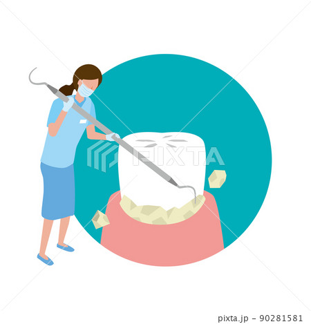 歯石を除去してクリーニングする歯科衛生士 90281581