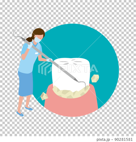 歯石を除去してクリーニングする歯科衛生士 90281581