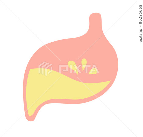 正常な胃 90285668