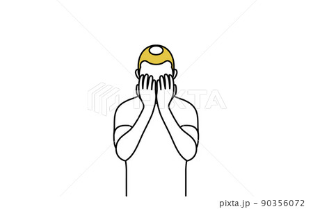 AGA 男性型脱毛症の男性、顔を手で覆って落ち込む AGA 男性型脱毛症の男性、顔を手で覆って落ち込む 90356072