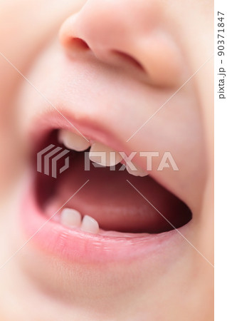 1歳の赤ちゃんに生えた乳歯 90371847