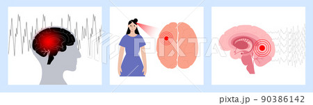 epilepsy seizure concept 90386142