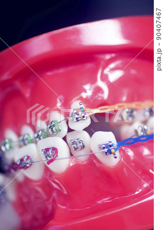 Dental teeth aligners brackets 90407467