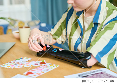 Young female with myoelectric arm putting stickers on black prosthesis 90474180