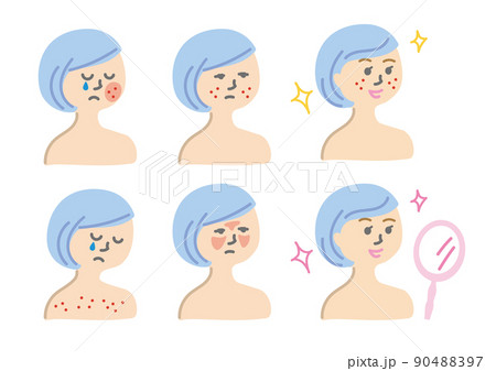 肌荒れに悩む女性ビフォアーアフター 肌荒れに悩む女性ビフォアーアフター 90488397