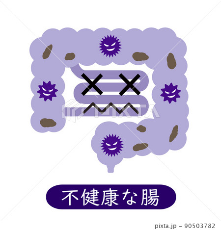 悪玉菌と便が溜まった不健康な腸。悪い腸内環境。 90503782