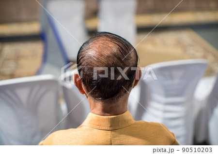 hair loss, thinning hair and scalp issue 90510203