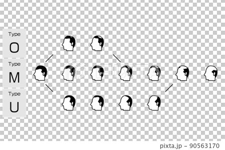 AGA　男性型脱毛症の各タイプと進行ステージのイラスト 90563170