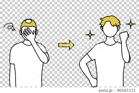 AGA 男性型禿髮，頭髮稀疏 90563172