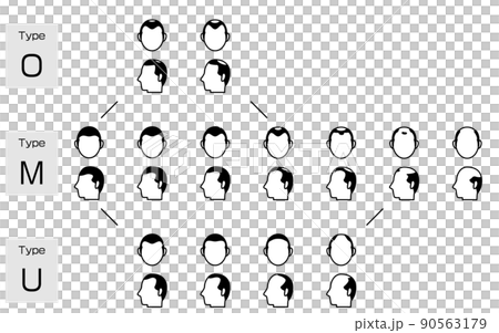 AGA　男性型脱毛症の各タイプと進行ステージのイラスト 90563179