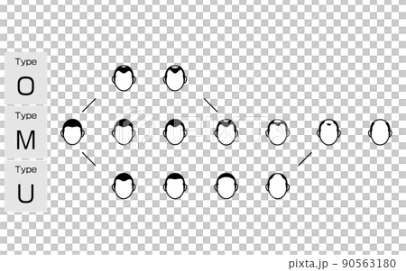 AGA 男性型脱毛症の各タイプと進行ステージのイラスト AGA 男性型脱毛症の各タイプと進行ステージのイラスト 90563180