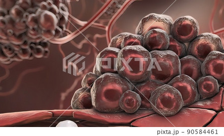 Cancer cells attacking white blood cells Cancer cells attacking white blood cells 90584461