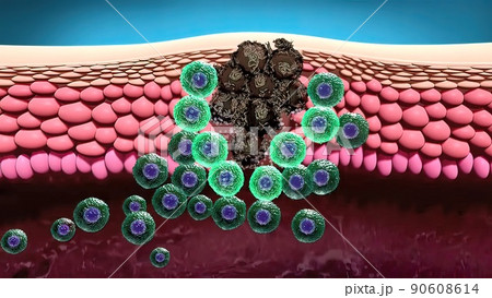 cells destroy cancer 3d medical cells destroy cancer 3d medical 90608614