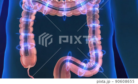 The Human Digestive System. 3D illustration of the colonoscopy Procedure 90608655