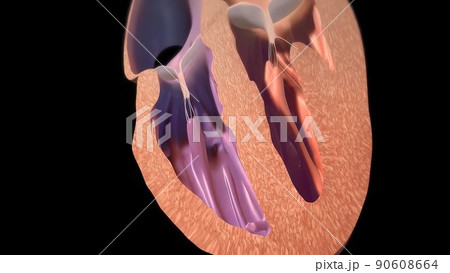 illustration Congestive Heart Failure illustration Congestive Heart Failure 90608664